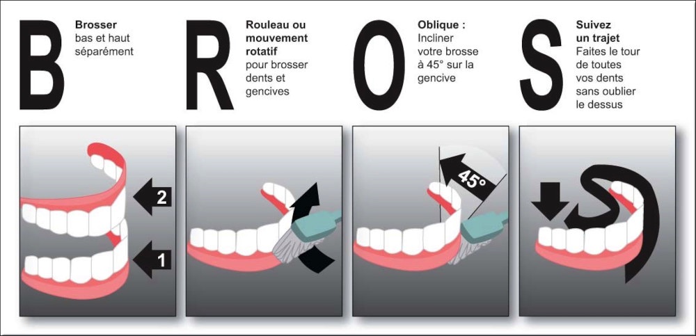 Conseils patients dentaires Crolles brossage dentaire